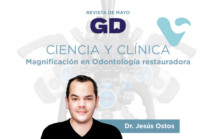 Magnificación en Odontología restauradora Portada - Jesus Ostos Gaceta Dental