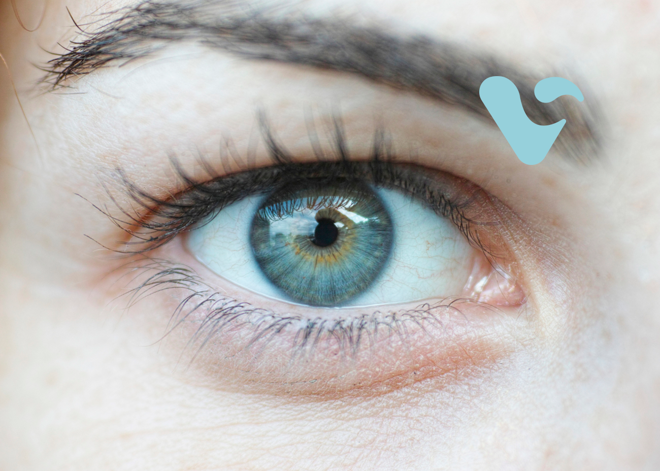 Dry eye syndrome in dentistry and surgery Síndrome del ojo seco