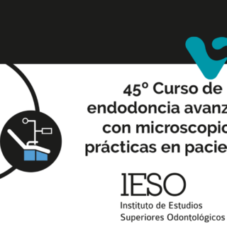 44º Curso de Endodoncia Avanzada de IESO Portada de Blog- 44 Curso IESO